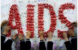13195 small kasus hiv aids pada anak