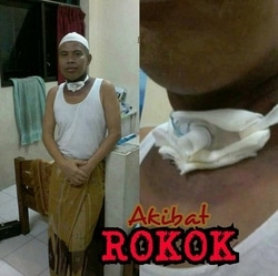 17539 small bahaya asa rokok!